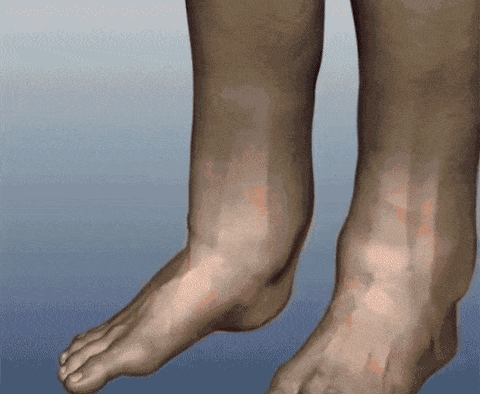 Postur Masseur de Pieds - Pour un soulagement durable de la douleur aux pieds