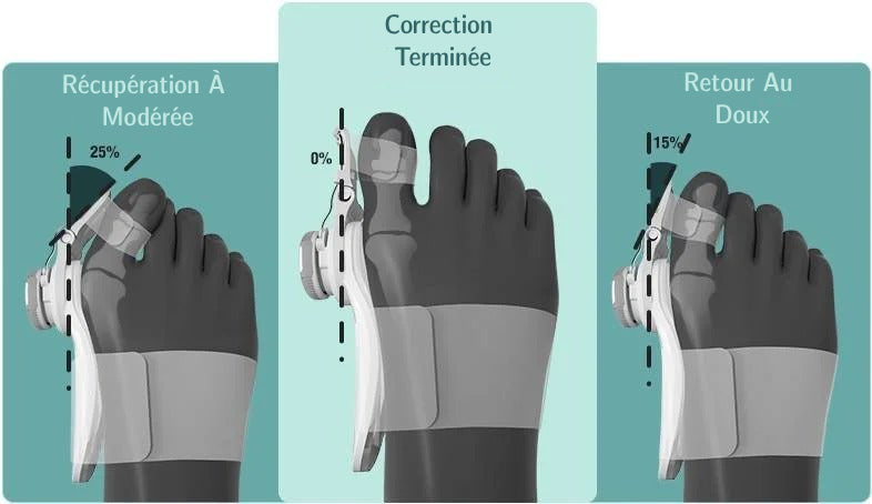 Sonnette Oignon Correcteur